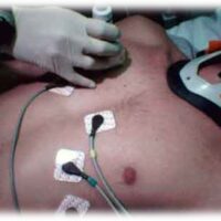 Point of Care Ultrasound - POCUS Training from FAST, to ruling out AAA, cholelithiasis, hydronephrosis, extra uterine pregnancies and more.